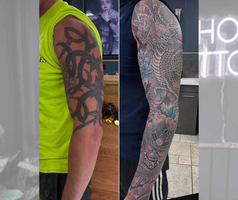 GOT A TATTOO YOU DON’T LOVE?